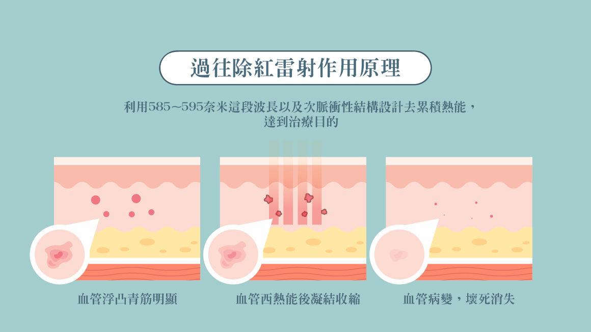 傳統解決血管浮凸青筋明顯的方式